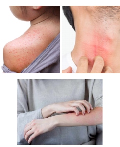 Medicated antifungal dusting powder - HFL Healthcare & Wellness